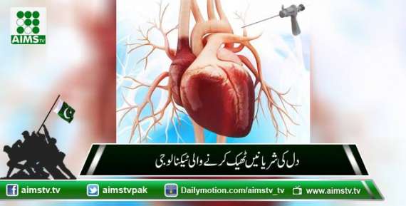 دل کی شریانیں ٹھیک کرنے والی ٹیکنالوجی