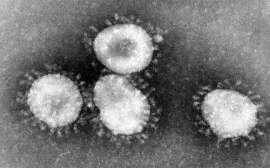 کرونا وائرس کھلی فضا میں کتنے گھنٹوں اور اشیا کی سطح پر کتنے دنوں تک زندہ رہتا ہے؟